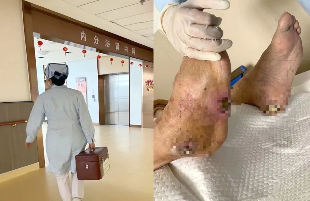【保山安利醫(yī)院】傷口治療一站式，健康生活零距離！